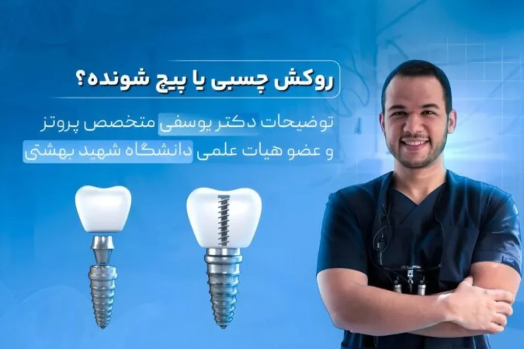 روکش چسبی بهتره یا پیچ شونده