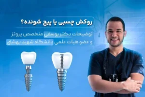 روکش چسبی بهتره یا پیچ شونده