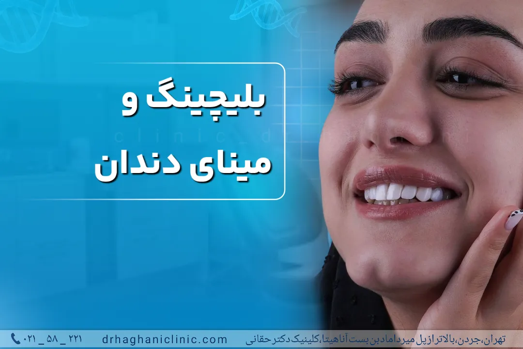 بلیچینگ و مینای دندان