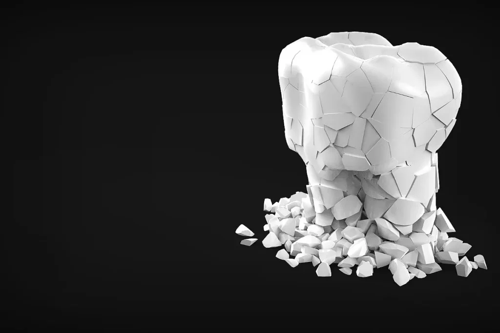 بلیچینگ دندان