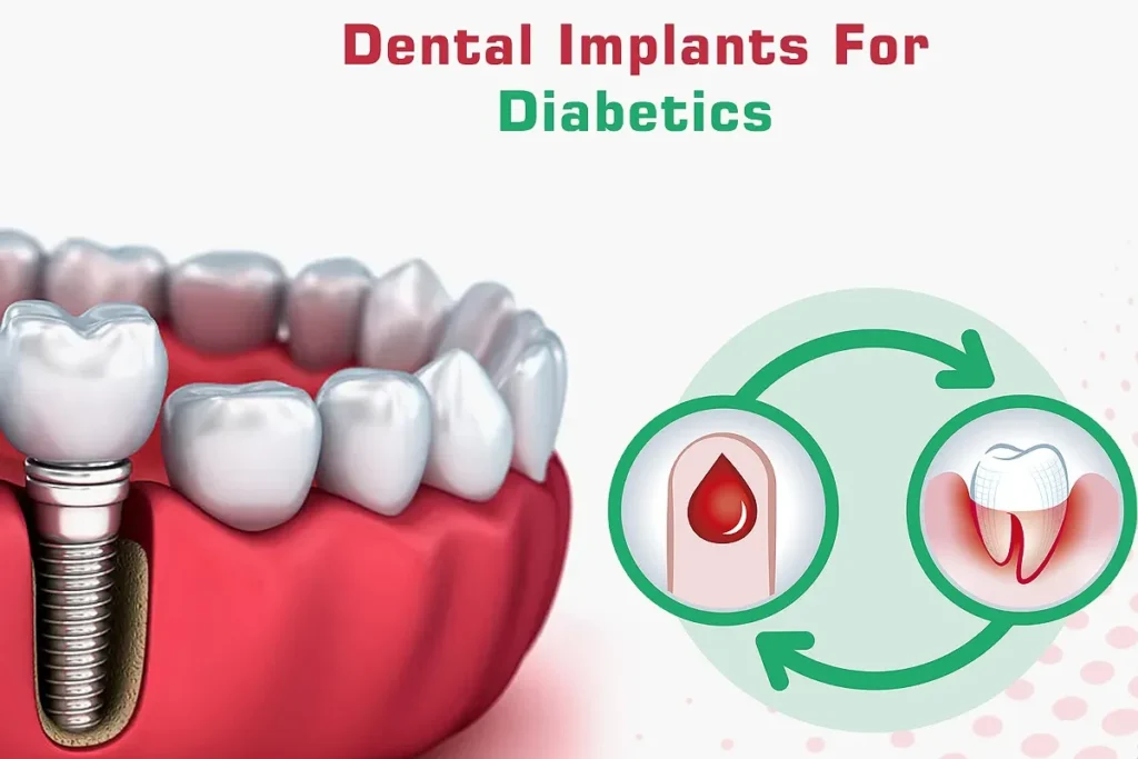 ایمپلنت دیابتی ها