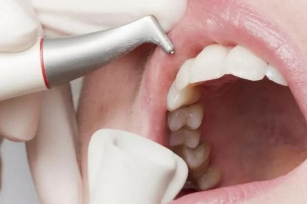 تفاوت airflow و بلیچینگ