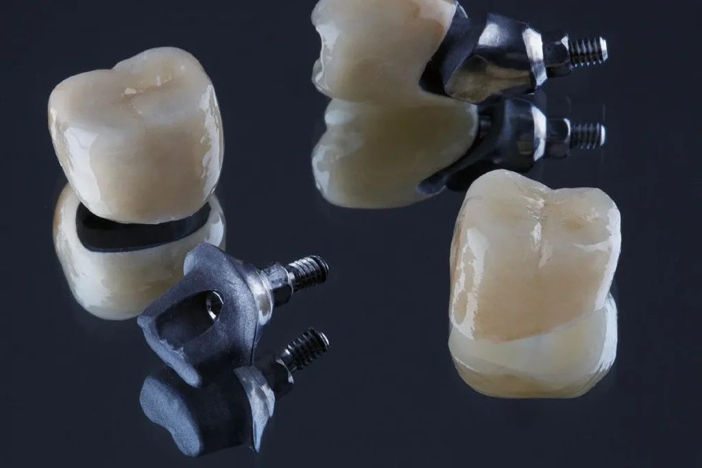 روکش ایمپلنت طبیعی دندان