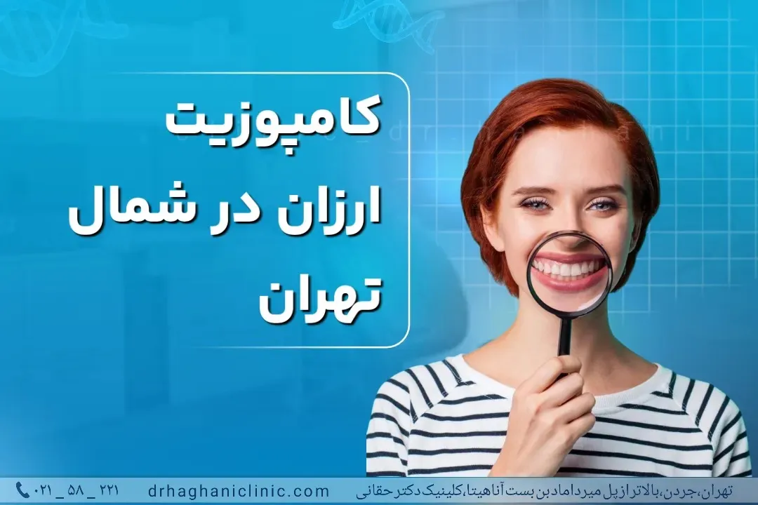 کامپوزیت ارزان در شمال تهران