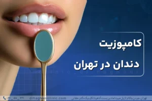کامپوزیت دندان در تهران