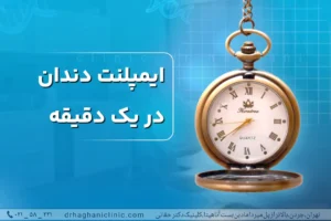 ایمپلنت دندان در یک دقیقه