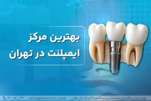 بهترین مرکز ایمپلنت در شمال تهران