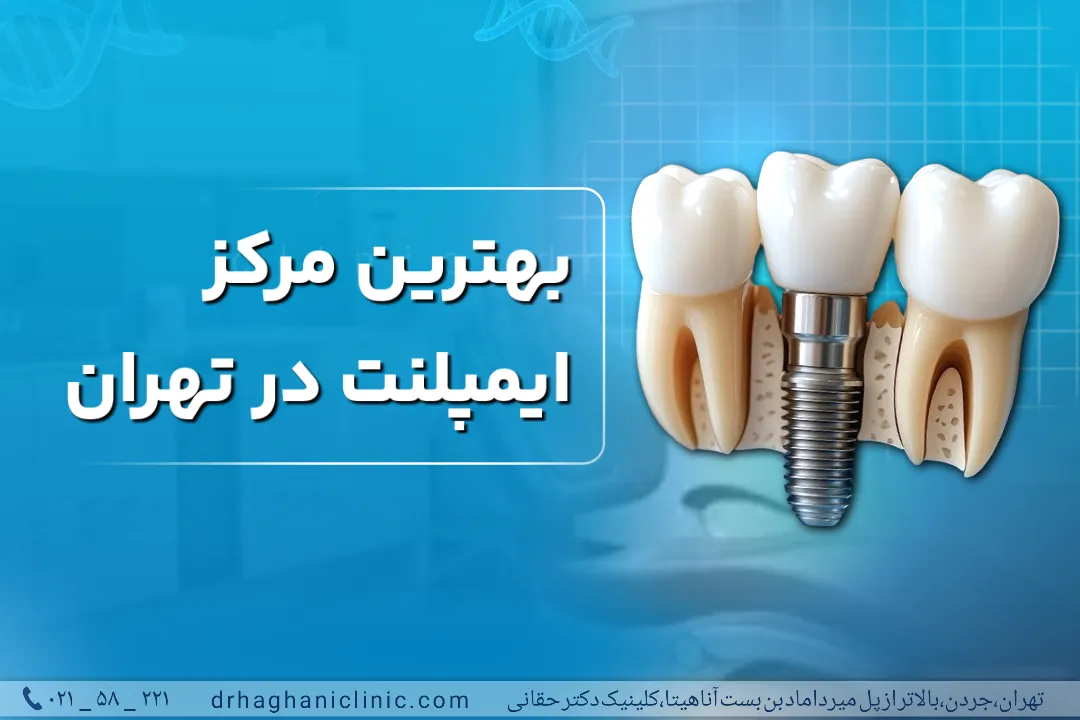 بهترین مرکز ایمپلنت در شمال تهران