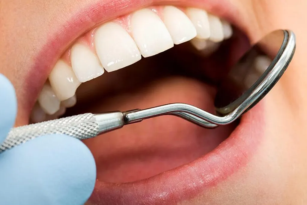 کامپوزیت دندان در تهران در کلینیک دکتر حقانی 