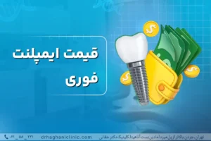 قیمت ایمپلنت فوری