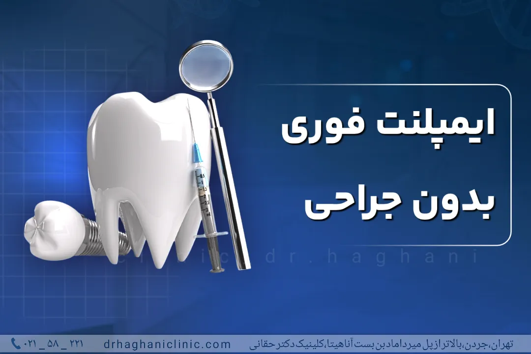 ایمپلنت فوری بدون جراحی