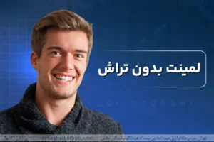 لمینت بدون تراش