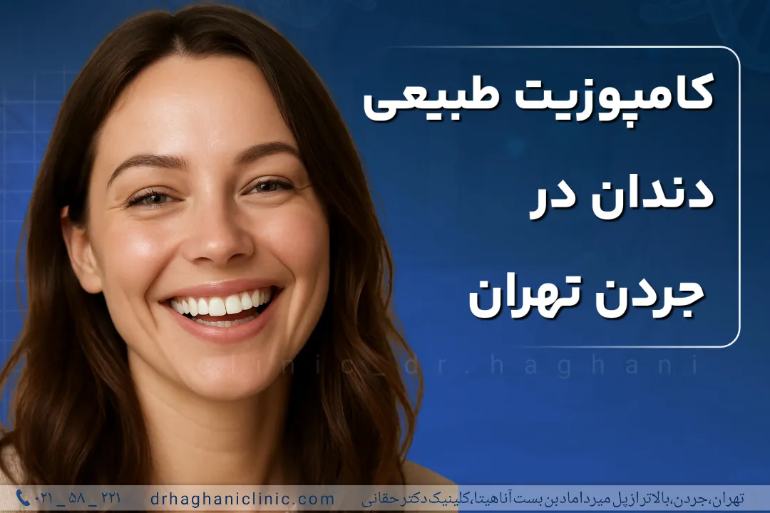 کامپوزیت طبیعی دندان در جردن تهران