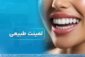 لمینت طبیعی