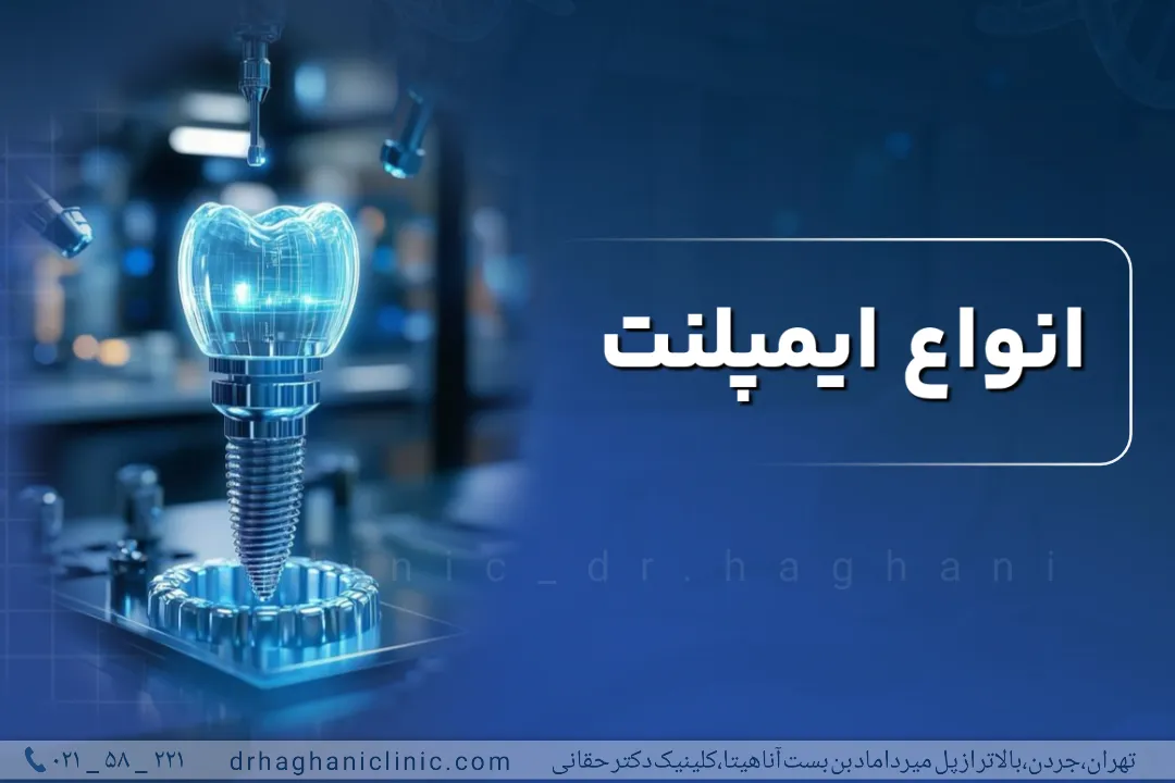 انواع ایمپلنت
