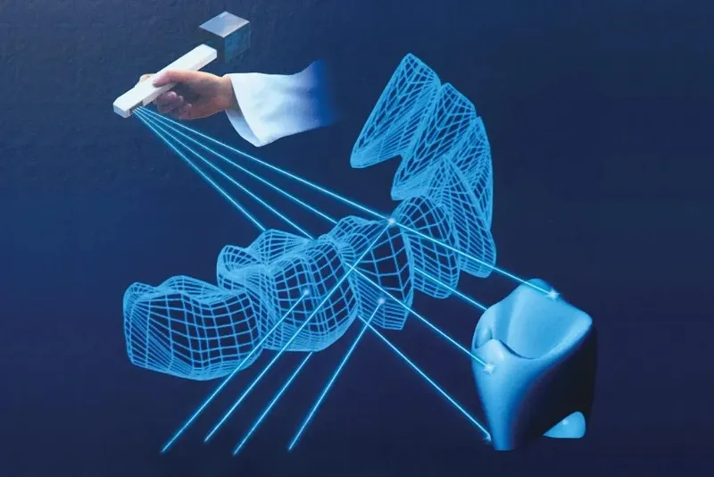 لمینت دندان