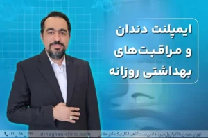 مراقبت بهداشتی ایمپلنت دندان
