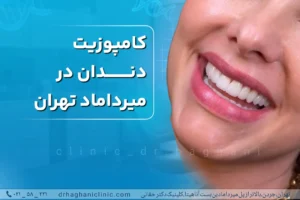 کامپوزیت دندان در میرداماد تهران