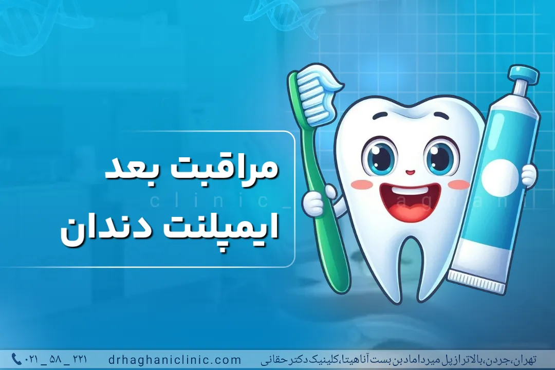 مراقبت بعد از ایمپلنت