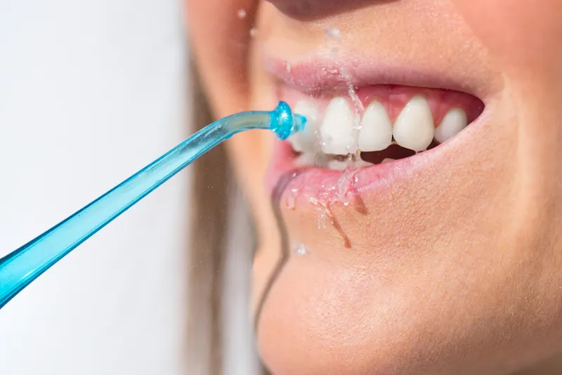 رعایت بهداشت دهان و دندان پس از ایمپلنت