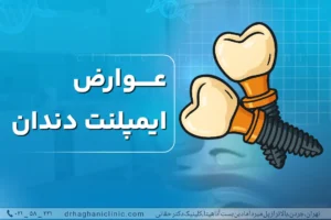 عوارض ایمپلنت دندان