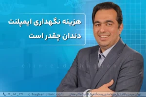 هزینه نگهداری ایمپلنت دندان