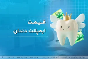قیمت ایمپلنت دندان