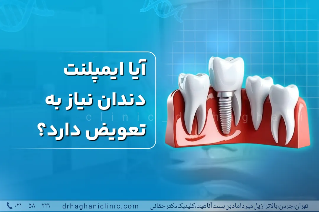 آیا ایمپلنت دندان نیاز به تعویض دارد؟