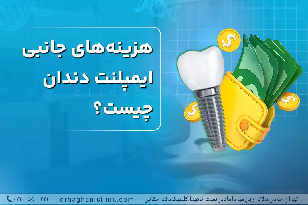هزینه‌های جانبی ایمپلنت دندان چیست؟
