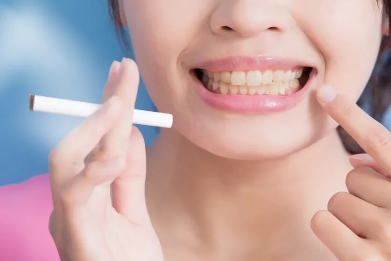 تاثیر سیگار بر روند ترمیم استخوان پس از ایمپلنت