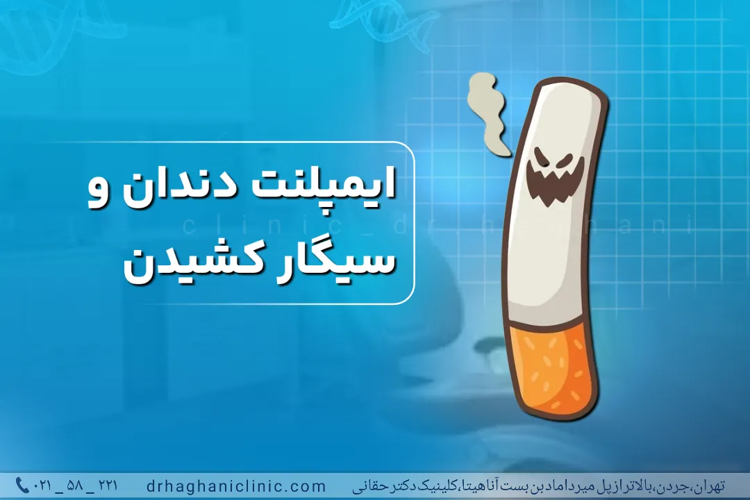 ایمپلنت دندان و سیگار کشیدن