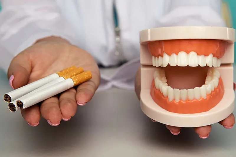 تاثیر سیگار بر روند ترمیم استخوان پس از ایمپلنت