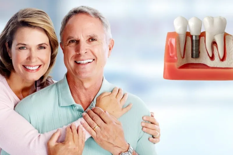 ایمپلنت در بزرگسالان