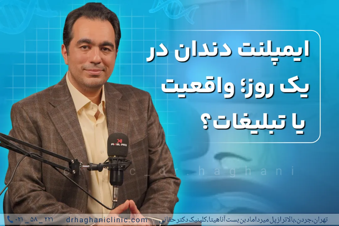 ایمپلنت دندان در یک روز