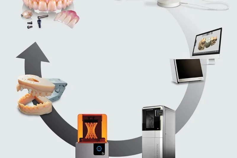 تفاوت ایمپلنت سنتی و ایمپلنت CAD/CAM