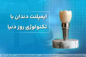 ایمپلنت دندان با تکنولوژی روز