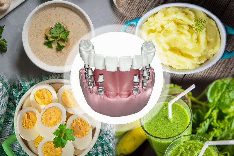 رژیم غذایی بعد کاشت ایمپلنت