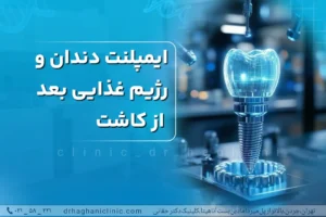 رژیم غذایی ایمپلنت دندان