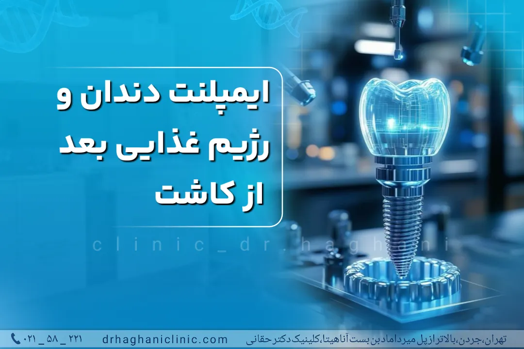 رژیم غذایی ایمپلنت دندان