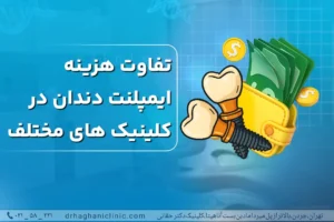 تفاوت هزینه ایمپلنت دندان در کلینیک های مختلف