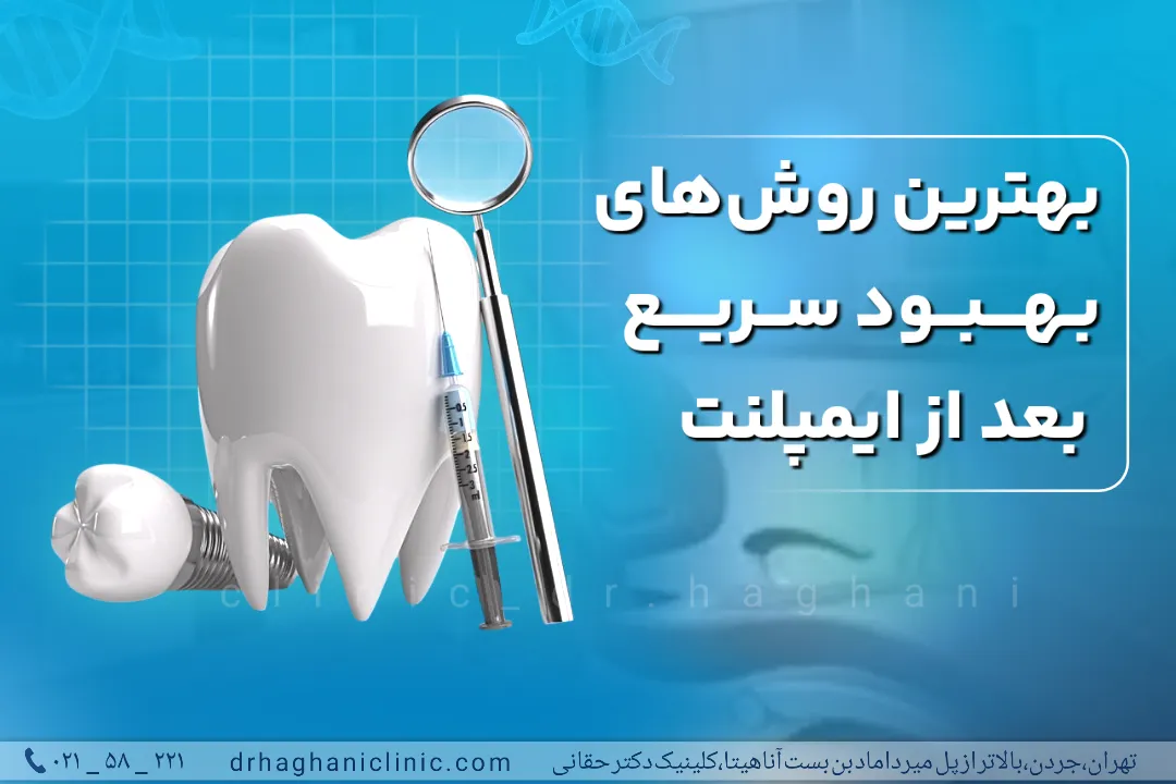 بهترین روش بهبود سزیع دندان بعد ایمپلنت