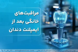 مراقبت‌های خانگی بعد از ایمپلنت دندان