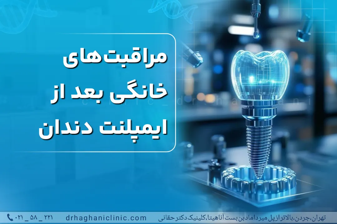 مراقبتهای خانگی بعد از ایمپلنت دندان