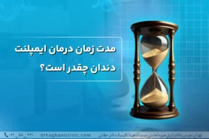 مدت زمان انجام ایمپلنت