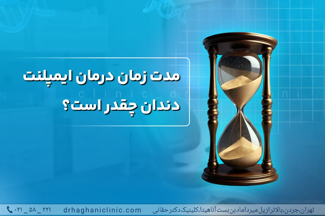 مدت زمان انجام ایمپلنت