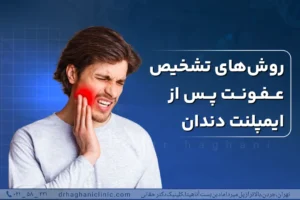 روش تشخیص عفونت بعد ایمپلنت