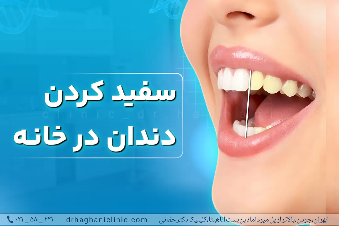 سفید کردن دندان در خانه با ترفندهای سایت دکتر حقانی