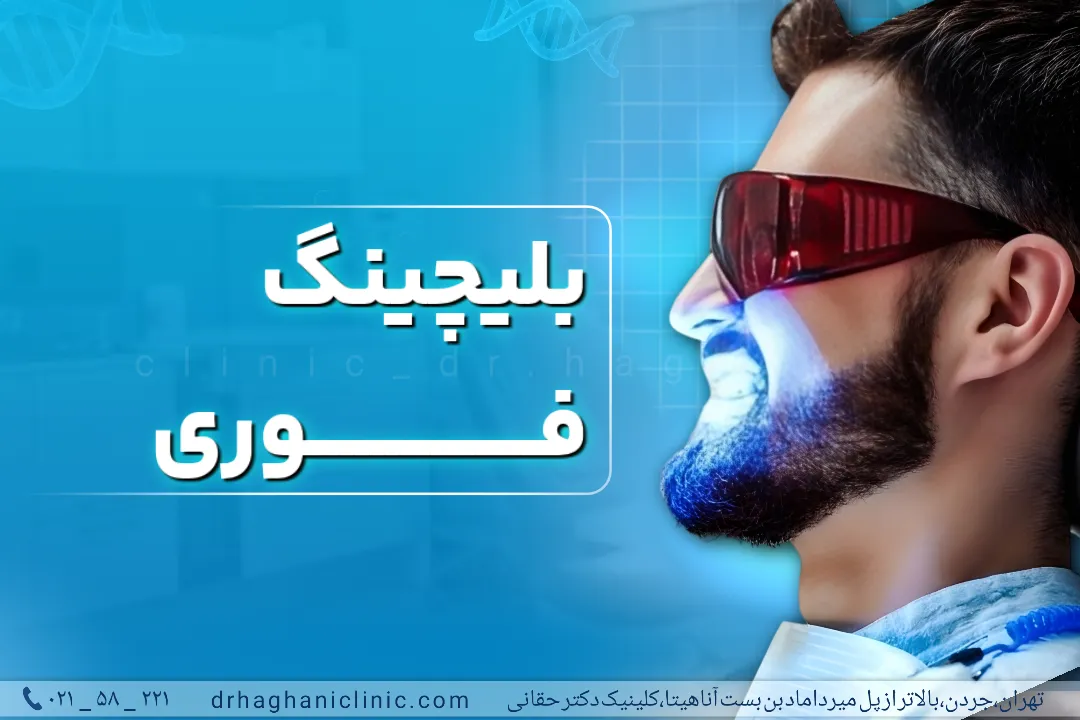 بلیچینگ فوری در کلینیک دندانپزشکی دکتر حقانی در جردن تهران