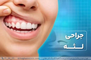 جراحی لثه در کلینیک دکتر حقانی
