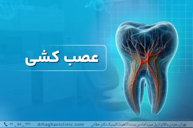 عصب کشی دندان در شمال تهران